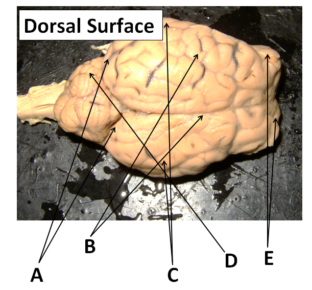 Brain anatomy quiz label